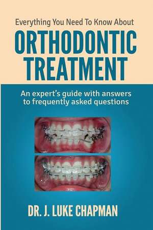 Everything You Need to Know about Orthodontic Treatment de Dr J. Luke Chapman