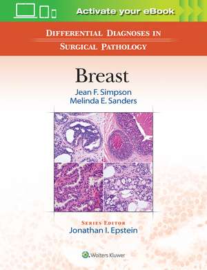 Differential Diagnoses in Surgical Pathology: Breast de Jean F. Simpson MD