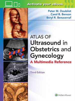 Atlas of Ultrasound in Obstetrics and Gynecology de Peter M. Doubilet MD, PhD