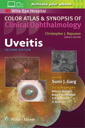 Uveitis de Sunir J. Garg