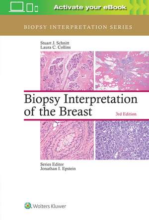 Biopsy Interpretation of the Breast de Stuart J. Schnitt MD