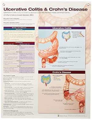 Ulcerative Colitis & Crohn's Disease Anatomical Chart Laminated de Anatomical Chart Company