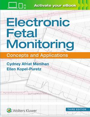 Electronic Fetal Monitoring: Concepts and Applications de Cydney Afriat Menihan