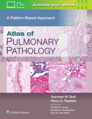 Atlas of Pulmonary Pathology: A Pattern Based Approach de Yasmeen Mahmood Butt MD