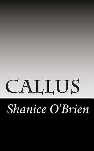 Callus de Shanice O'Brien