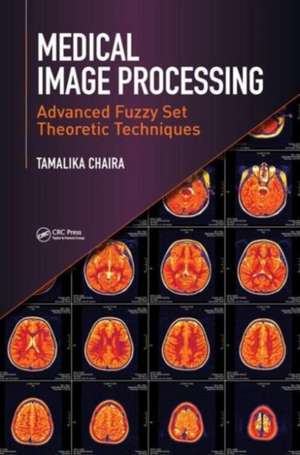 Medical Image Processing: Advanced Fuzzy Set Theoretic Techniques de Tamalika Chaira
