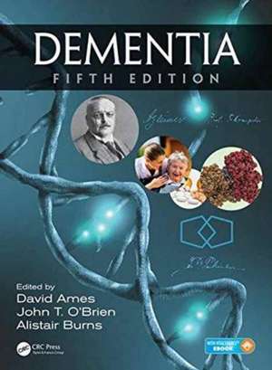 Dementia de David Ames