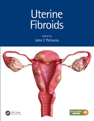 Uterine Fibroids de John C. Petrozza