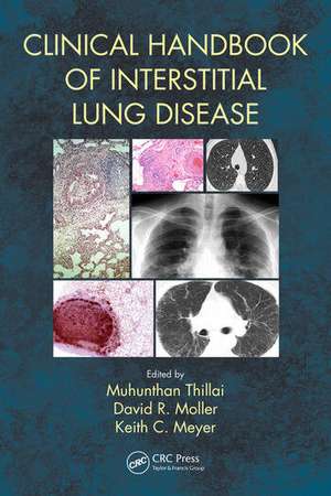 Clinical Handbook of Interstitial Lung Disease de Keith C. Meyer