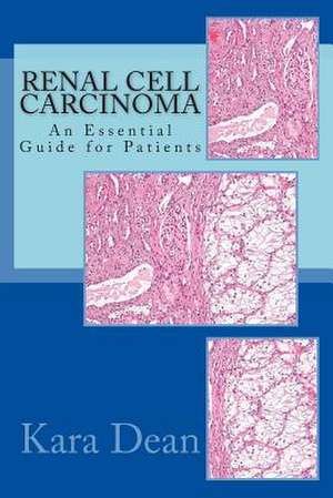 Renal Cell Carcinoma de Kara Dean Ma