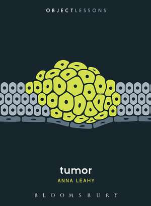 Tumor de Dr. Anna Leahy