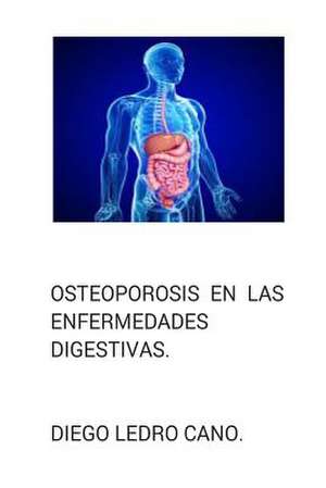 Osteoporosis En Las Enfermedades Digestivas. de Dr Diego Ledro-Cano