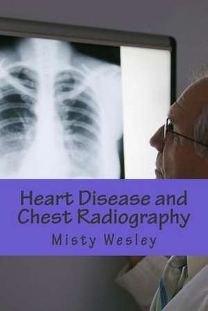 Heart Disease and Chest Radiography de Misty L. Wesley