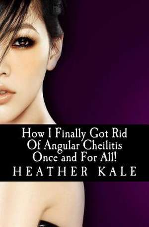 How I Finally Got Rid of Angular Cheilitis Once and for All! de Heather Kale