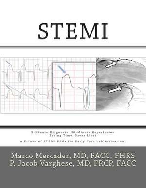 Stemi de Marco a. Mercader MD