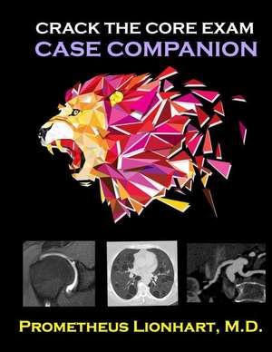 Crack the Core Exam - Case Companion de Prometheus Lionhart M. D.