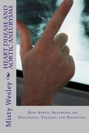 Heart Disease and Aortic Aneurysms de Misty L. Wesley