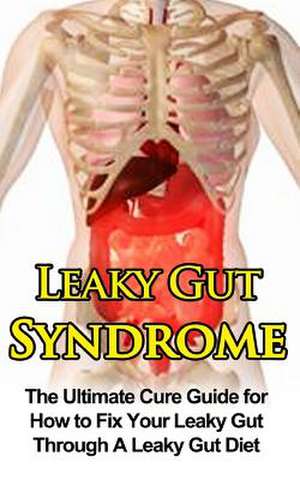 Leaky Gut Syndrome de Wade Migan