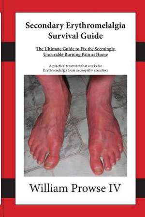 Secondary Erythromelalgia Survival Guide de William E. Prowse IV