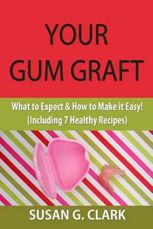 Your Gum Graft de Susan G. Clark