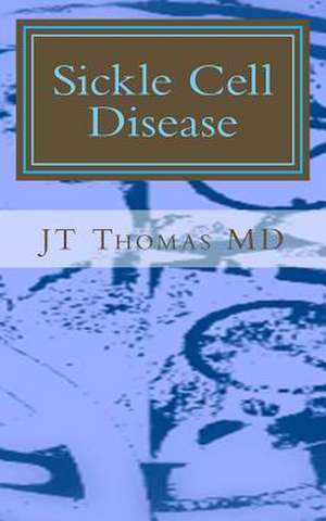 Sickle Cell Disease de Jt Thomas MD