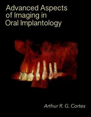 Advanced Aspects of Imaging in Oral Implantology de Arthur Rodriguez Gonzalez Cortes