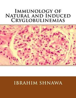 Immunology of Natural and Induced Cryoglobulinemia de Ibrahim M-S Shnawa