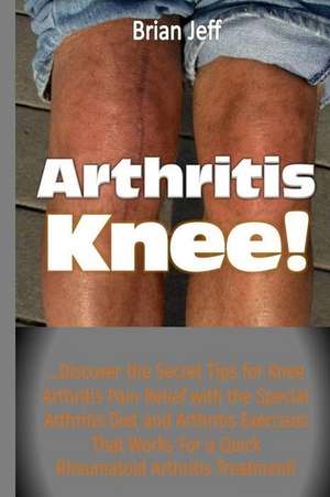 Arthritis Knee! de Brian Jeff