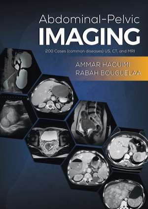 Abdominal-Pelvic Imaging de Ammar Haouimi