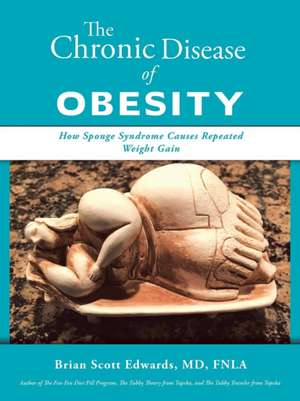 The Chronic Disease of Obesity de Brian Scott Edwards MD FNLA