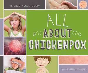 All about Chickenpox de Megan Borgert-Spaniol