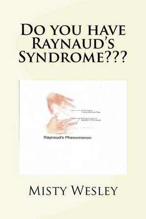 Do You Have Raynaud's Syndrome de Misty Lynn Wesley