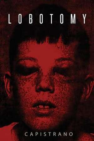 Lobotomy de Capistrano