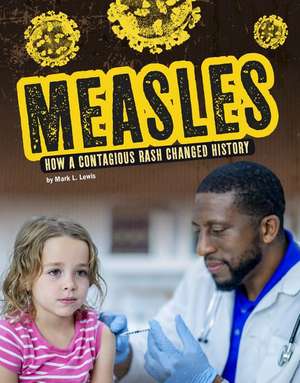 Measles: How a Contagious Rash Changed History de Mark K. Lewis