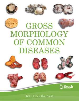 Gross Morphology of Common Diseases de Zu-Hua Gao