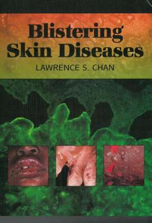 Blistering Skin Diseases de Lawrence S. Chan