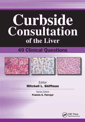 Curbside Consultation of the Liver: 49 Clinical Questions de Mitchell Shiffman