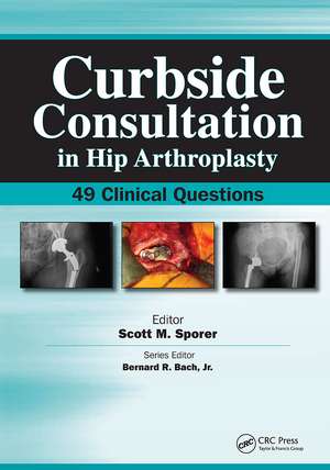 Curbside Consultation in Hip Arthroplasty: 49 Clinical Questions de Scott Sporer