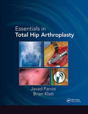 Essentials in Total Hip Arthroplasty de Javad Parvizi