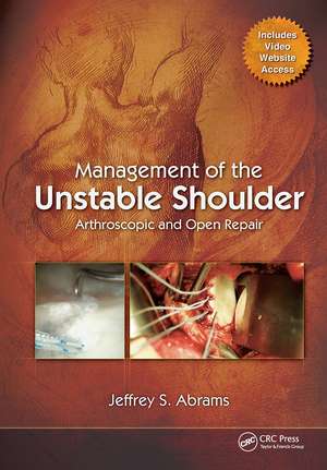 Management of the Unstable Shoulder: Arthroscopic and Open Repair de Jeffrey Abrams