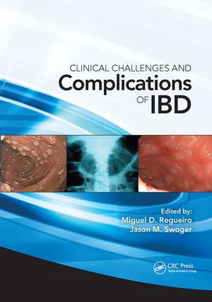 Clinical Challenges and Complications of IBD de Miguel Regueiro