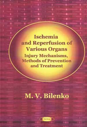 Ischemia & Reperfusion of Various Organs: Injury Mechanisms, Methods of Prevention & Treatment de M V Bilenko