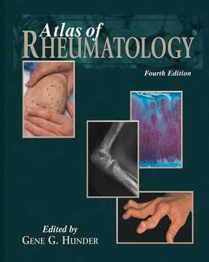 Atlas of Rheumatology de Gene G. Hunder