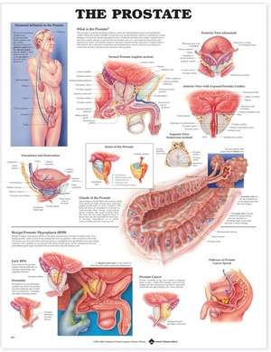 The Prostate Anatomical Chart de Anatomical Chart Company