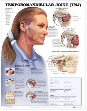 Temporomandibular Joint (TMJ) Anatomical Chart de Anatomical Chart Company