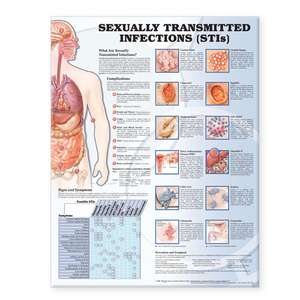 Sexually Transmitted Infections Anatomical Chart de Anatomical Chart Company