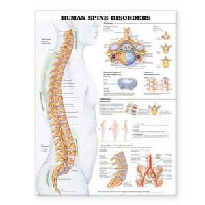 Human Spine Disorders Anatomical Chart de Anatomical Chart Company