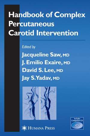 Handbook of Complex Percutaneous Carotid Intervention de Jacqueline Saw