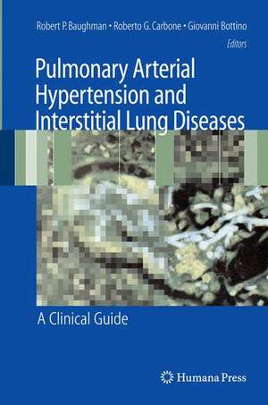 Pulmonary Arterial Hypertension and Interstitial Lung Diseases: A Clinical Guide de Robert P. Baughman