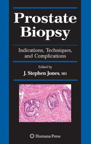 Prostate Biopsy: Indications, Techniques, and Complications de J. Stephen Jones